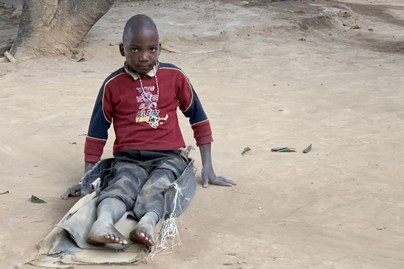 Immobile African child